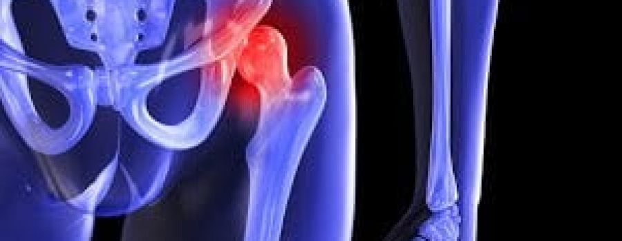 How to avoid hip surgery